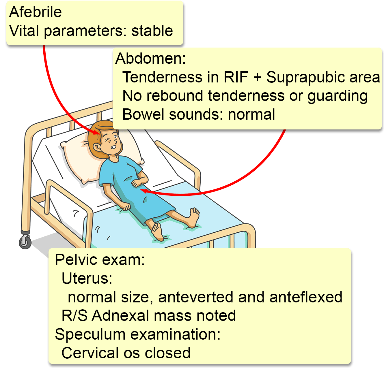 case study ectopic pregnancy