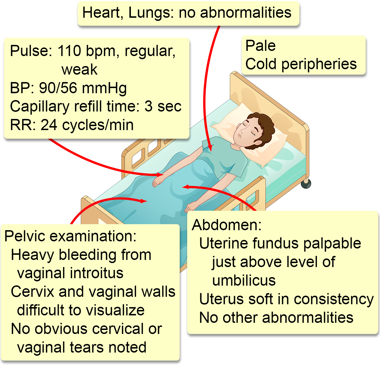 what is postpartum hemorrhage        <h3 class=