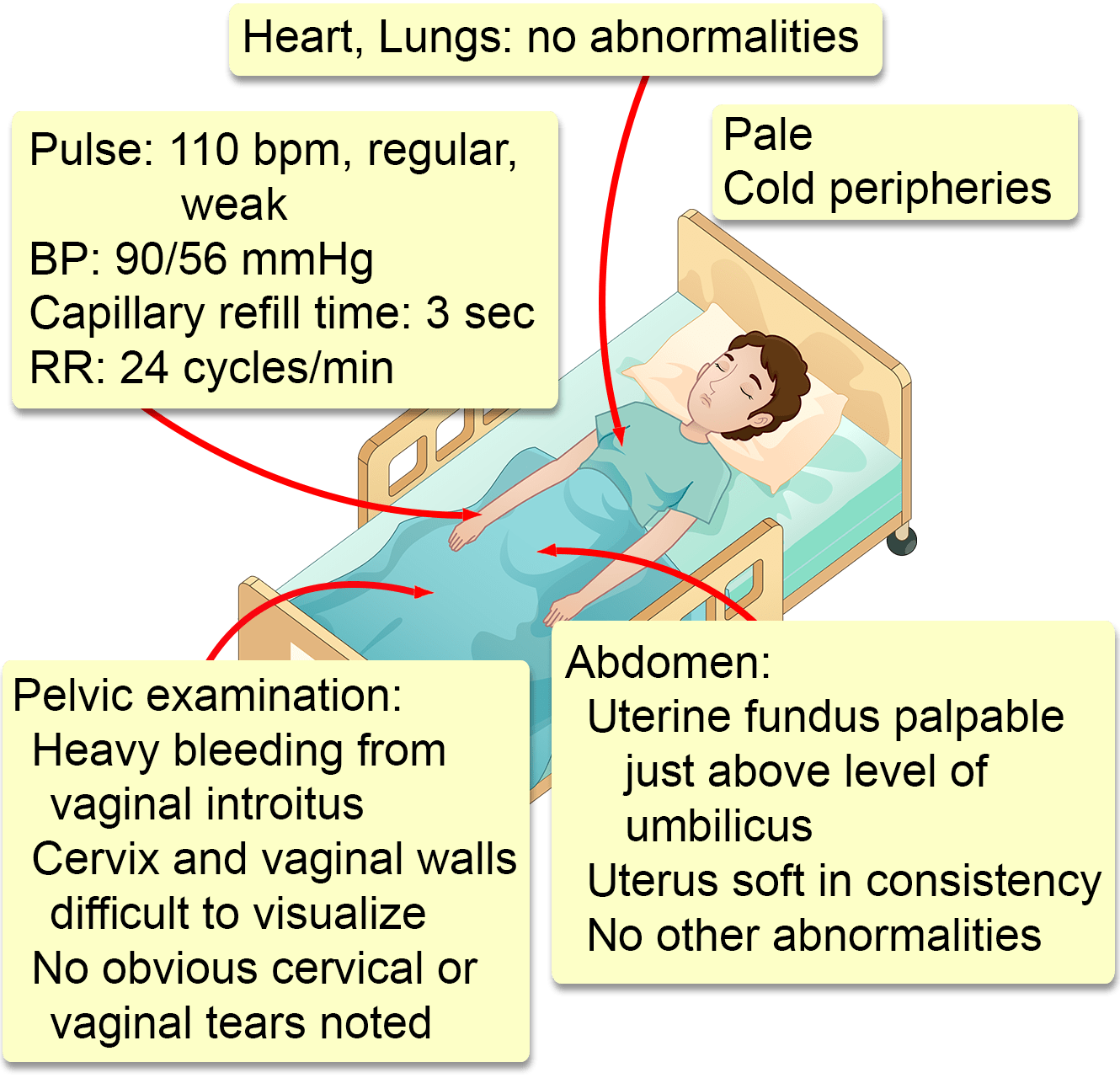 nursing case study for postpartum hemorrhage in slideshare