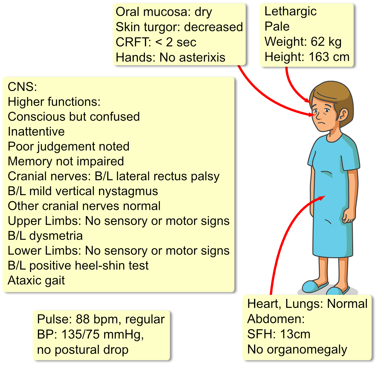 PDF) Hot cross bun sign in a case with multisystem atrophy