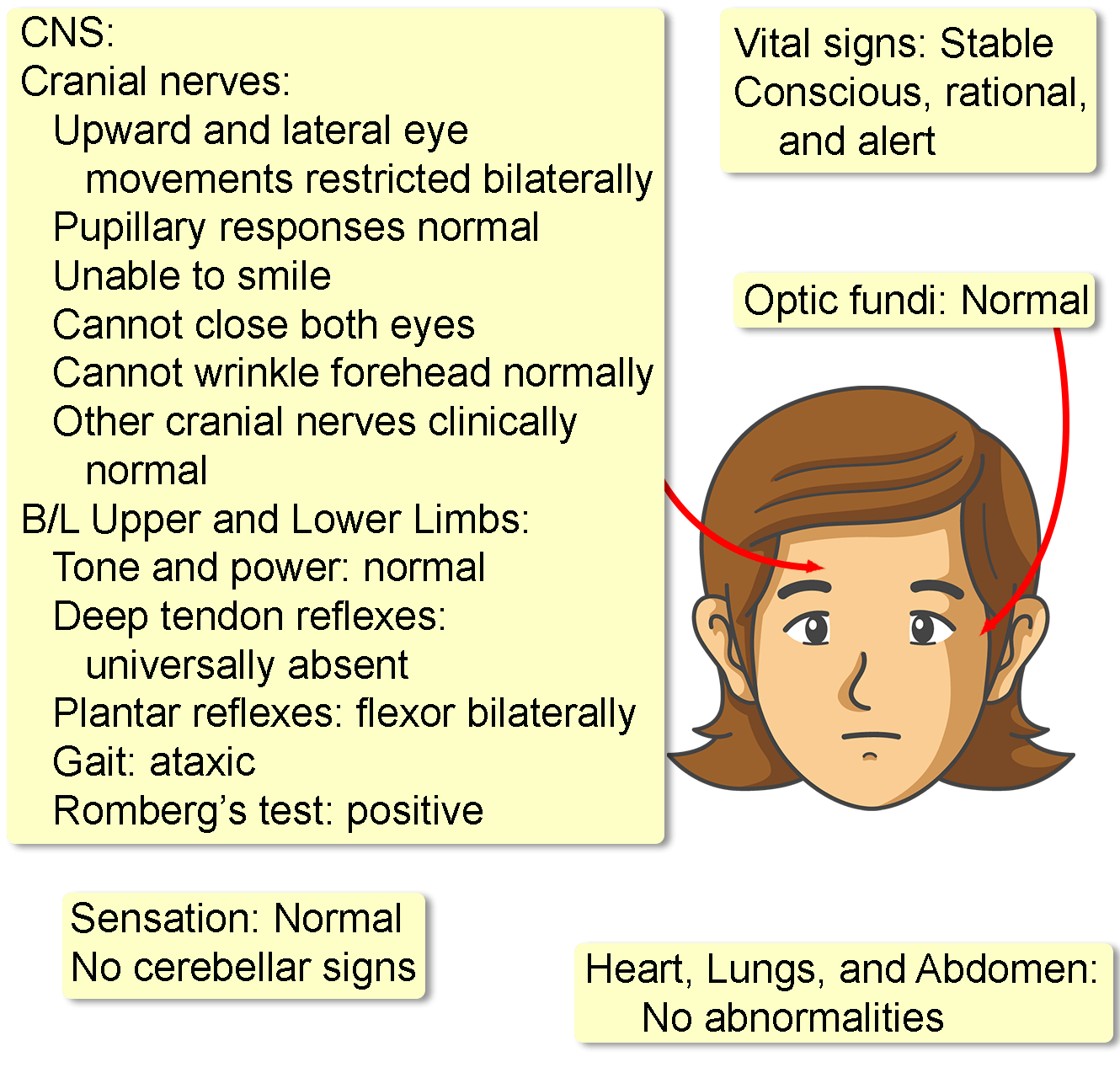 Miller Fisher Syndrome Interactive Case Study Clinical Odyssey By Miller Fisher Syndrome Interactive Case Study Clinical Odyssey By