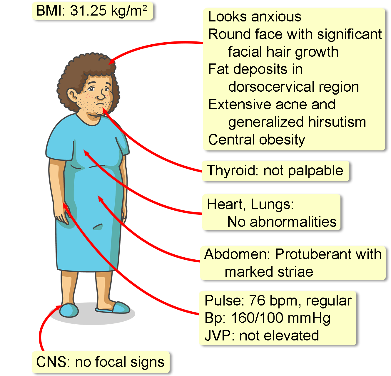 Cushing Syndrome Causes Symptoms Diagnosis Treatment vrogue.co