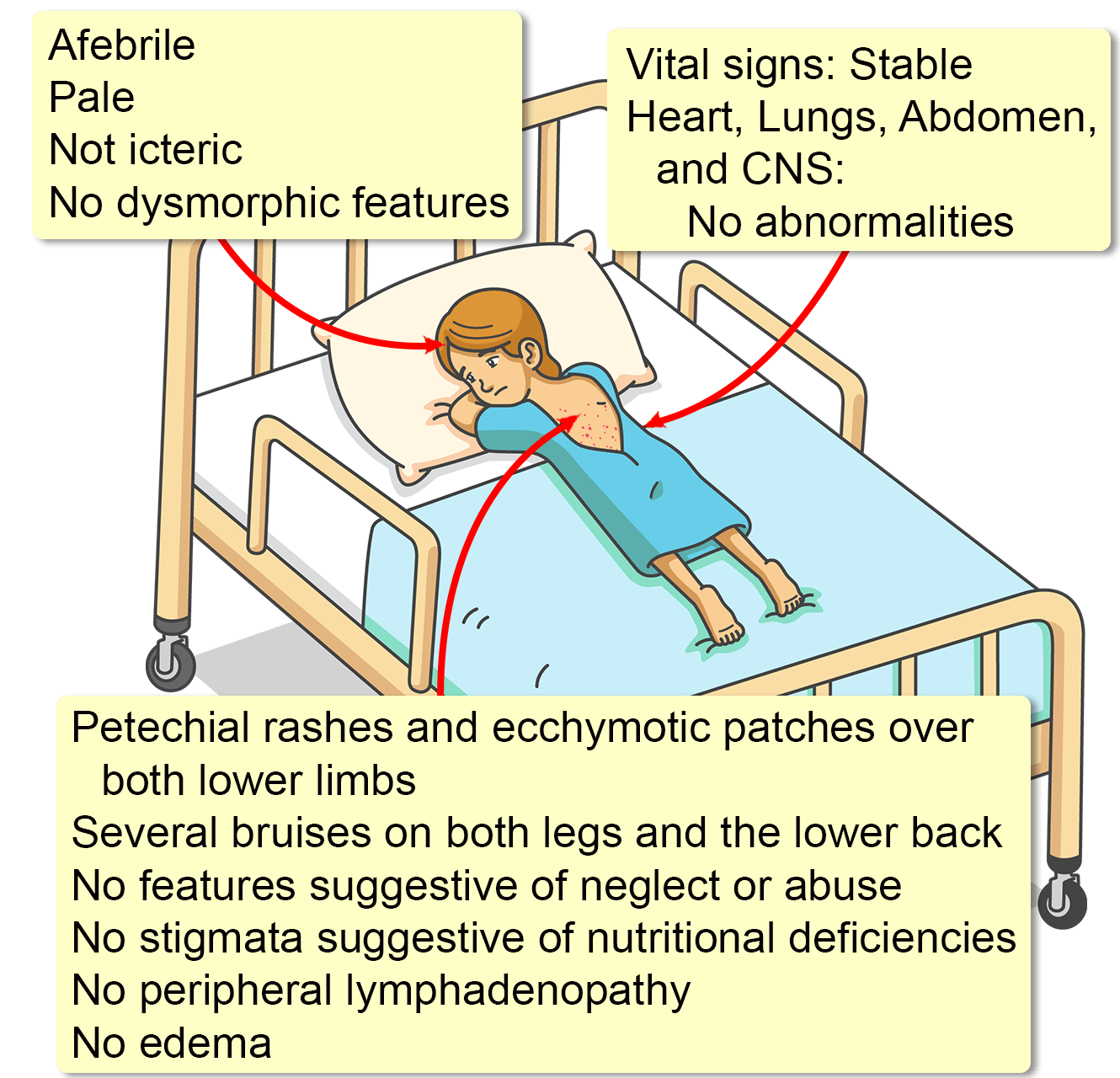 Aplastic Anemia Signs And Symptoms