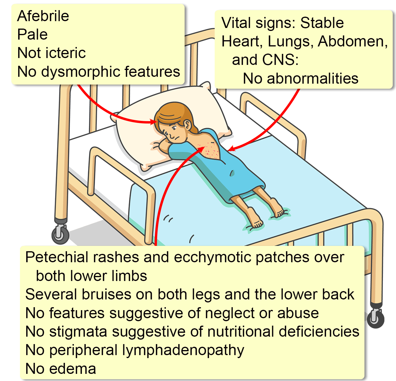 case study aplastic anemia