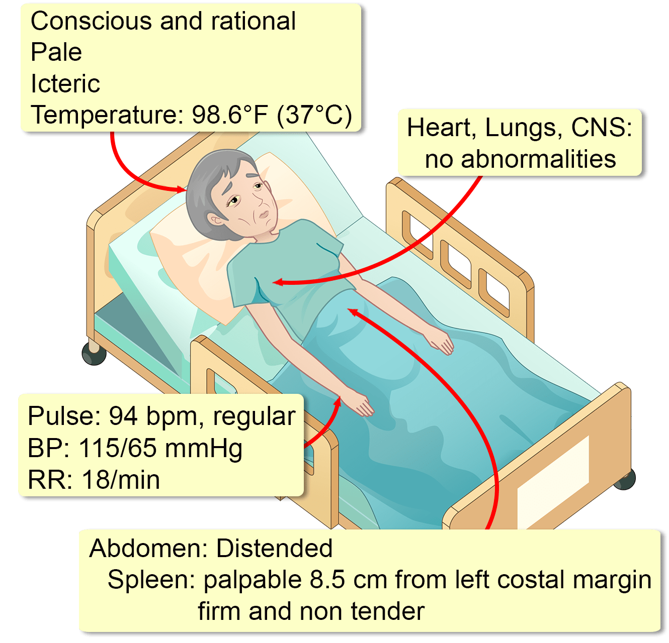 primary-myelofibrosis-interactive-case-study-clinical-odyssey-by