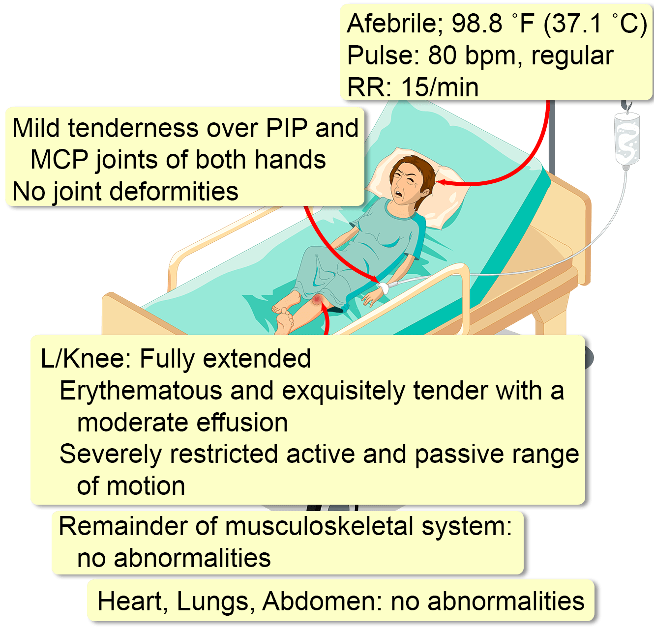 paediatric-septic-arthritis-orthosho