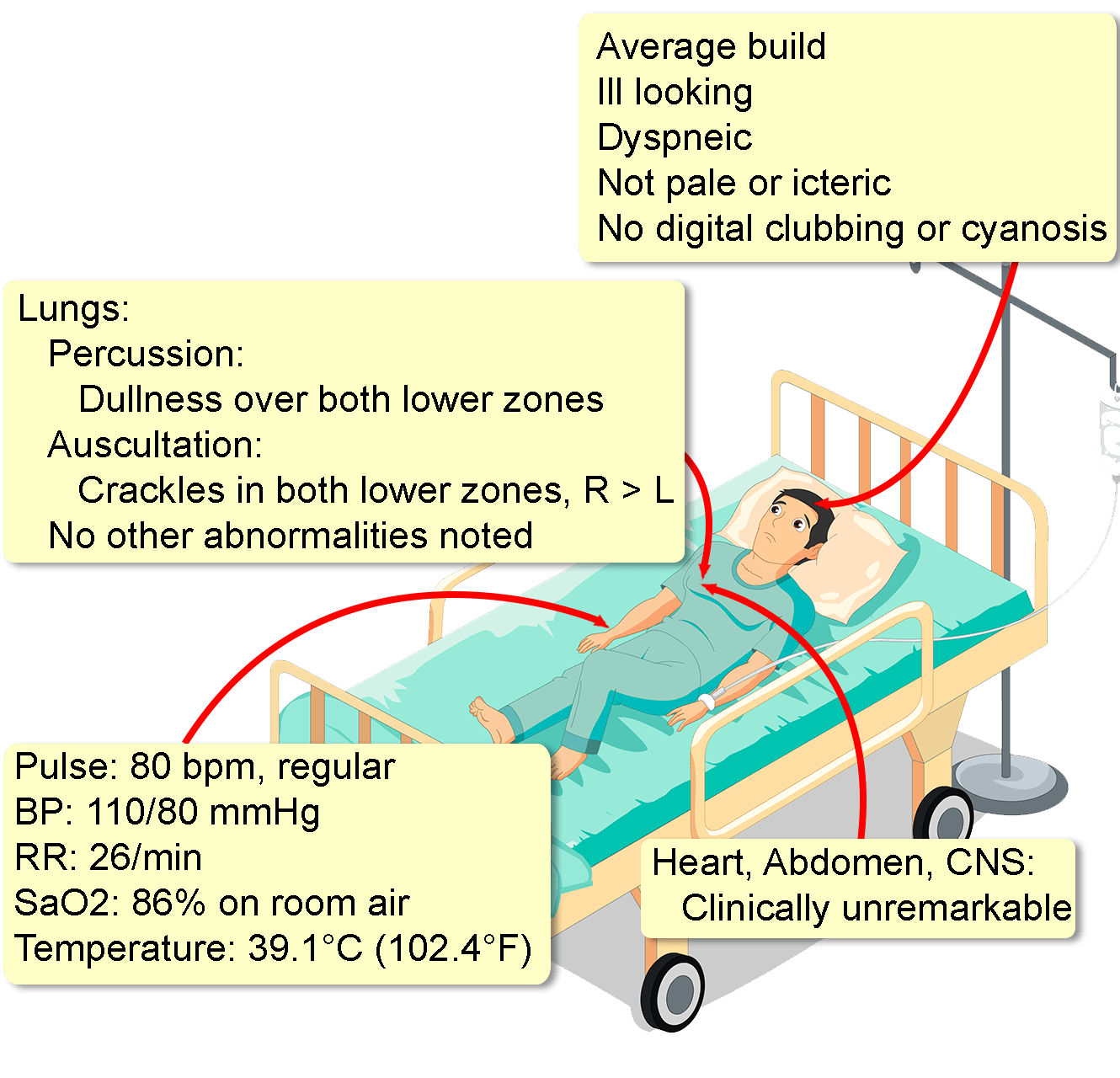 case study 1 legionnaires' disease answers