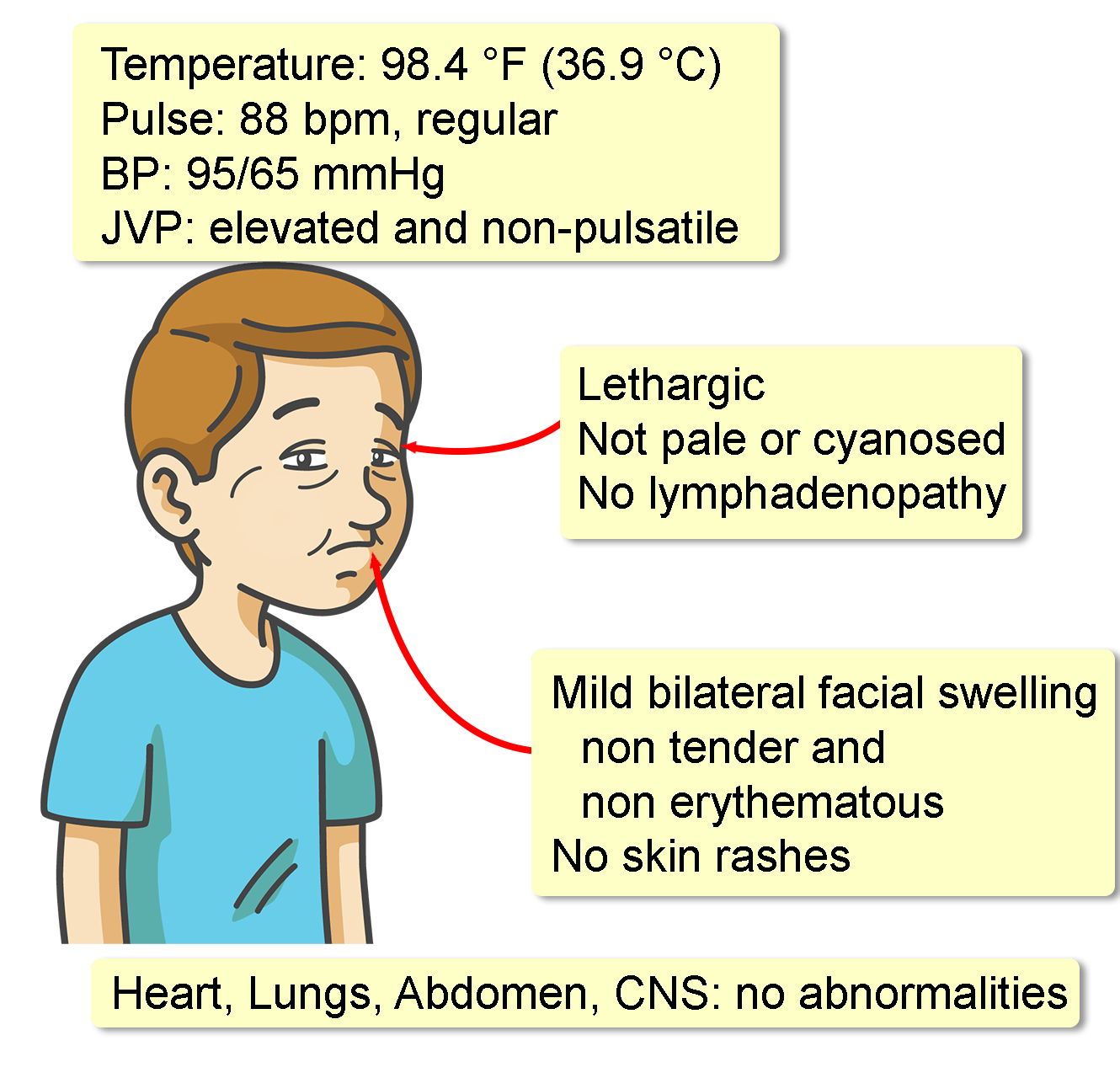 figure-7-from-congenital-absence-of-inferior-vena-cava-semantic-scholar