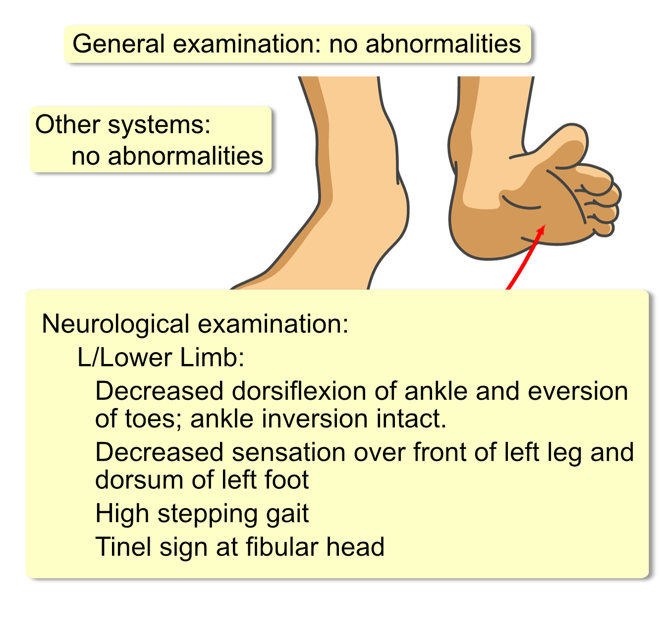 Common Peroneal Nerve Palsy Interactive Case Study Clinical Odyssey