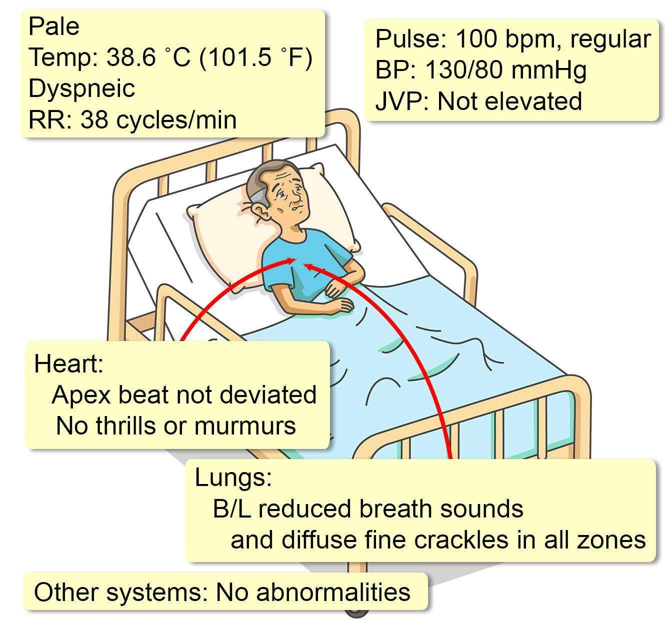 case study respiratory distress syndrome