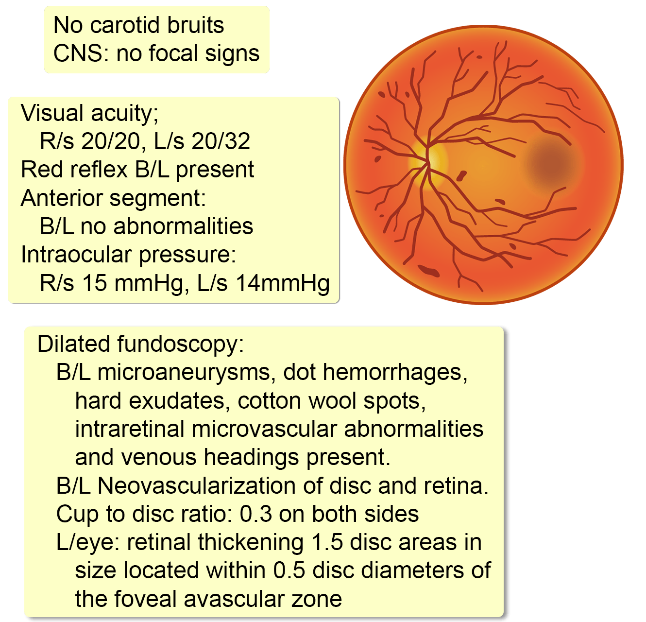 case study diabetic retinopathy