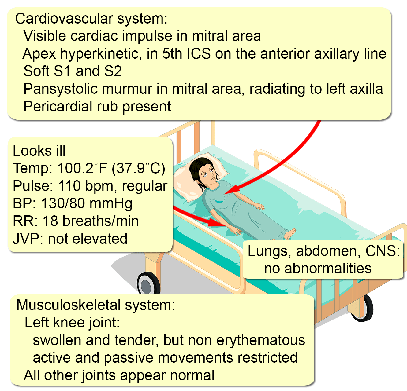 acute-rheumatic-fever-interactive-case-study-clinical-odyssey-by