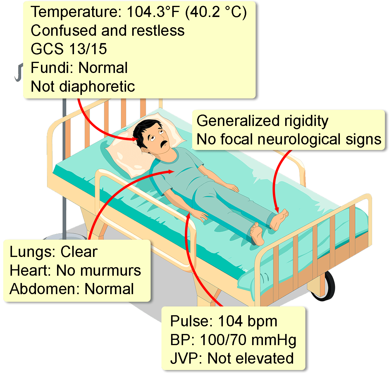 Neuroleptic Malignant Syndrome Interactive Case Study Clinical 